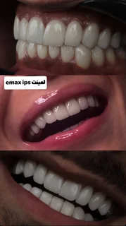 لمینیت